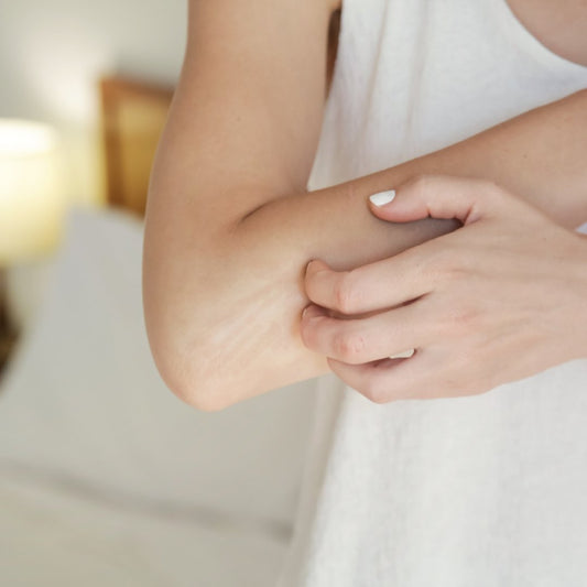 Top natural tips for eczema - NativeNeem